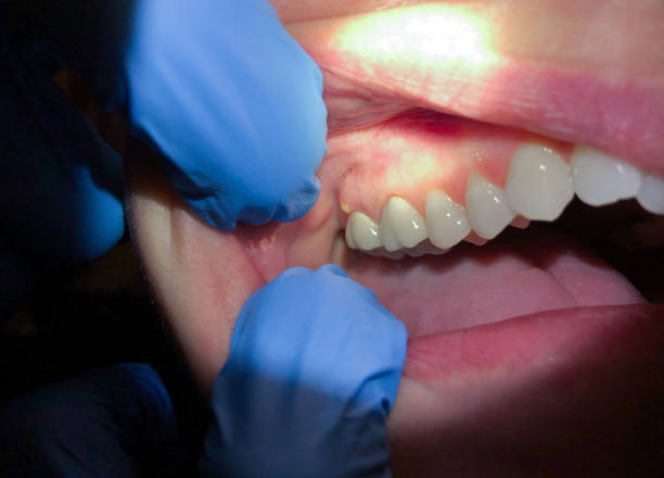 Best Broken or Cracked Tooth Emergency Dentist in Waverly, OH